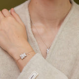 Gummy Bear Locket Bracelet – A Sparkle of Joy